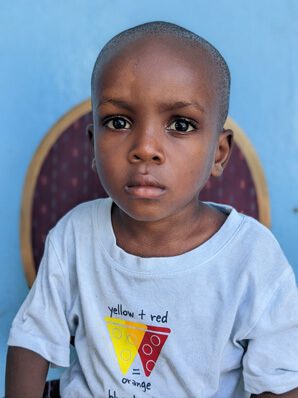 A young boy without hair looking at camera